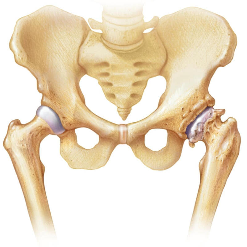 Afectiune ligamente genunchi